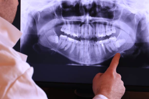 Best Emergency Dental Surgery in Port Salerno, FL